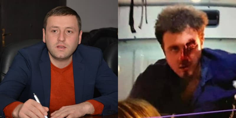 თაზო ფაცაცია: დემეტრეს ჩემს თვალს დავუთმობ!